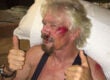 Richard Branson bike accident