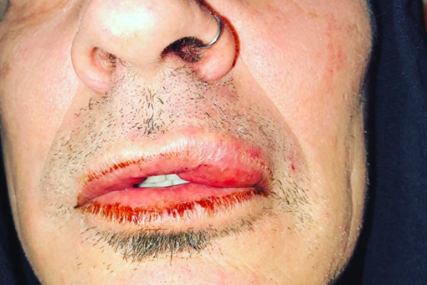 Tommy Lee - Instagram