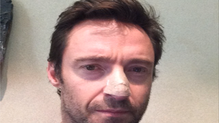 Hugh Jackman Treated for Skin Cancer