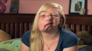 ‘The Girl With Half a Face’ Reveals Bullies as the Real ‘Monsters’ (Exclusive Video)