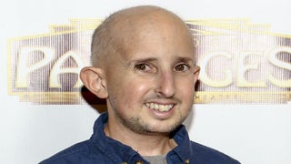‘American Horror Story’ Actor Ben Woolf Hit by Car, in Critical Condition