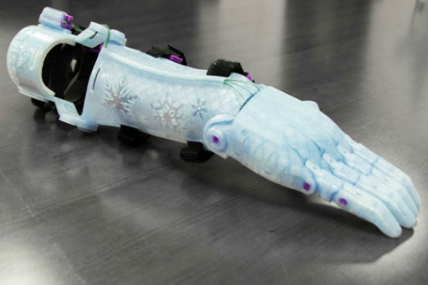 frozen prosthetic arm