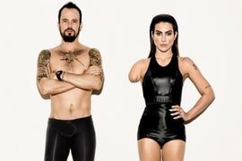 Vogue Brazil Under Fire for Photoshopping Models to Look Disabled