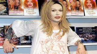 Pete Burns, Dead or Alive Founder, Dies at 57