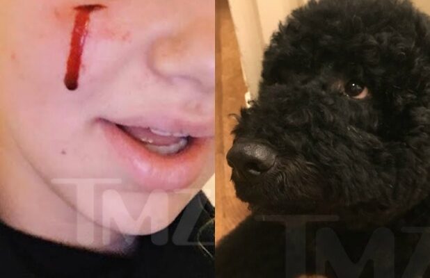 Presidential Dog Bite Sunny Injures A White House Guest