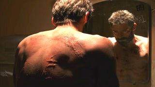 ‘Logan:’ What’s Wrong With Wolverine’s Incredible Healing Powers?