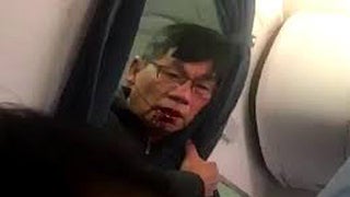 United Passenger David Dao Speaks Out: ‘Everything Is Injured’