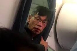 United Passenger David Dao Speaks Out: ‘Everything Is Injured’