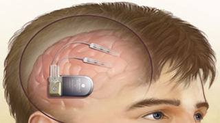 Meet the Human Cyborg Who Could Pave the Way for the Future