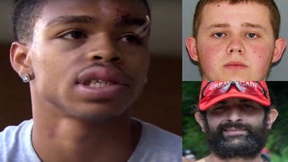 Suspect Arrested in Beating of Black Charlottesville Man; Second Suspect Sought