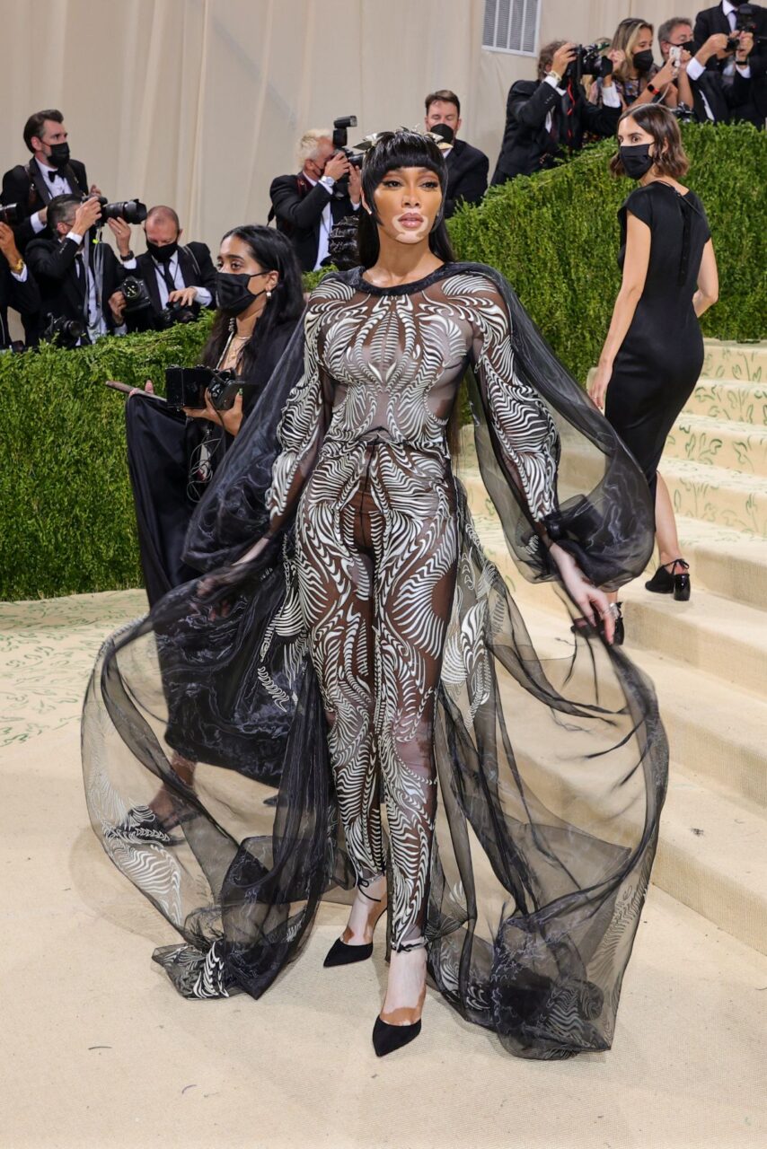 Winnie Harlow Winnie Harlow