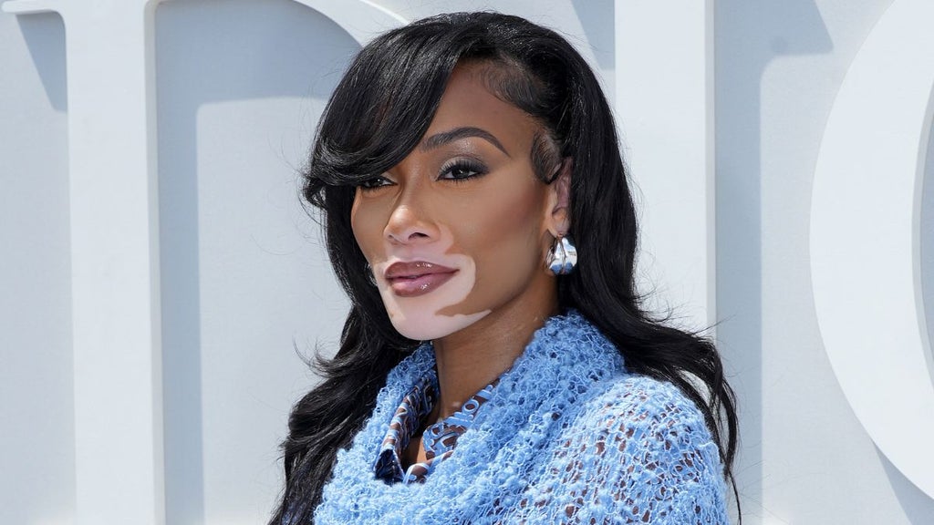 Winnie Harlow (Photo credit: Getty Images)