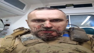 Ukranian Director-Turned-Soldier Oleg Senstov Injured in Battle