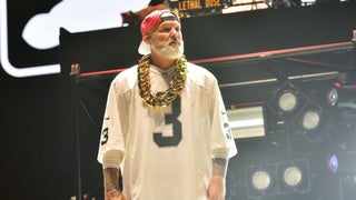 Limp Bizkit Sues Universal Music Group for Breach of Contract in Lawsuit That Could ‘Easily Surpass’ $200 Million