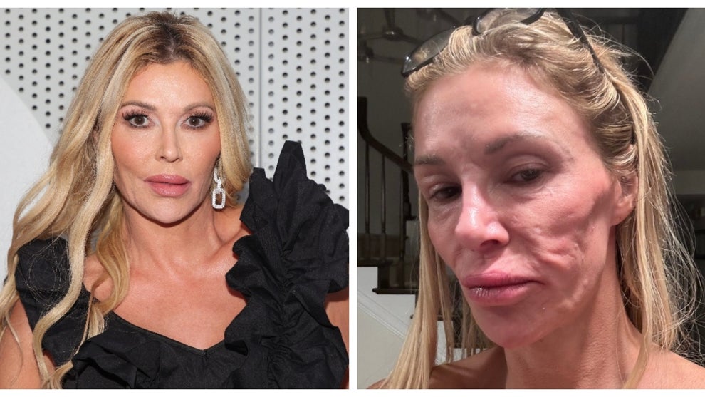 Brandi Glanville attends the grand opening of Beverly Hills Rejuvenation Clinic West Hollywood at Beverly Hills Rejuvenation Clinic West Hollywood on April 25, 2024 in West Hollywood, California