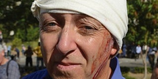 BBC Reporter Shot in Head Undergoes Successful Surgery